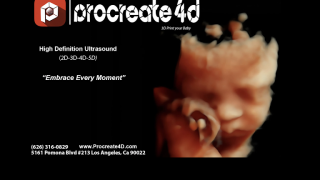 5d ultrasounds in los angeles PROCREATE 4D