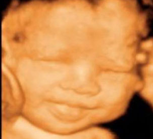 5d ultrasounds in los angeles 3D 4D Ultrasound by 4D Special Delivery