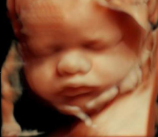5d ultrasounds in los angeles 3D 4D Ultrasound by 4D Special Delivery